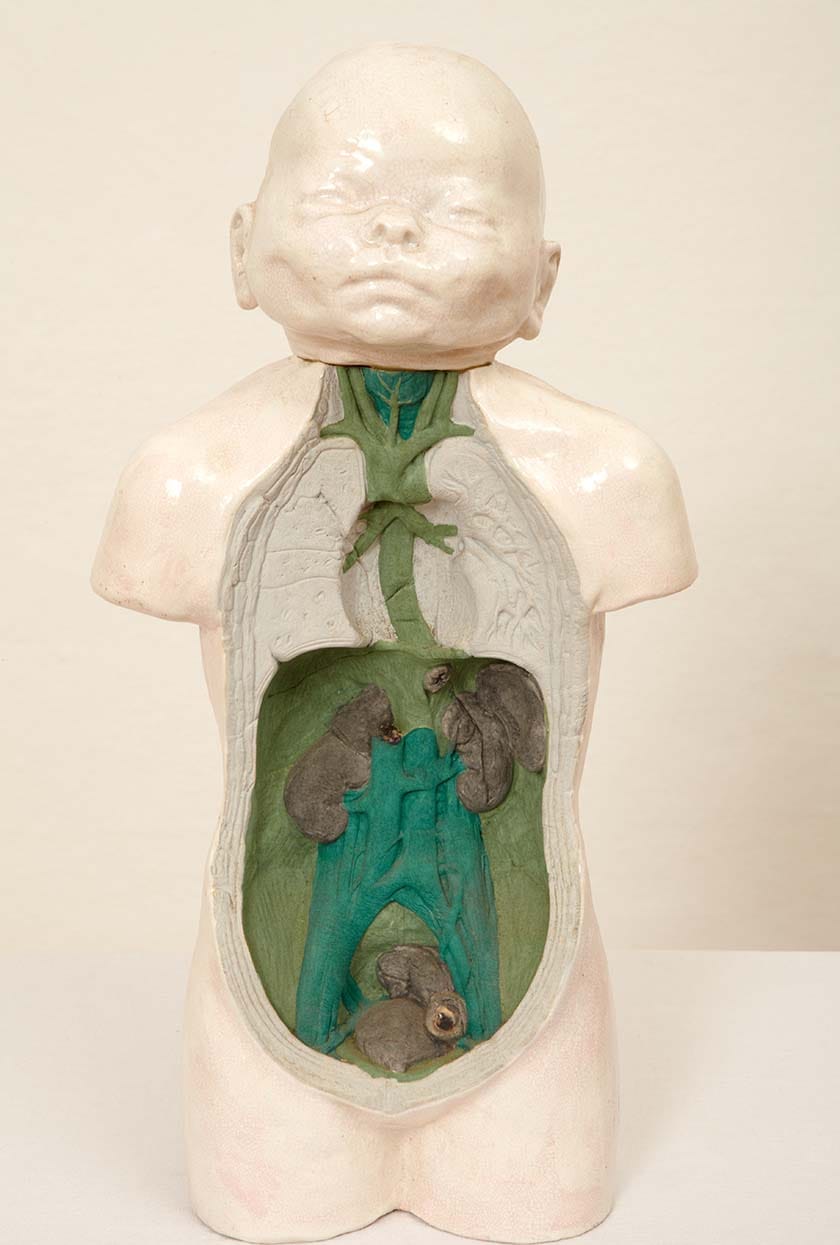 Malcolm Poynter: Baby