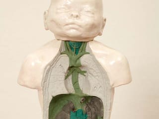 Malcolm Poynter: Baby